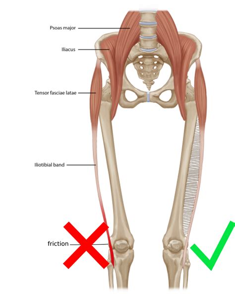 What Causes IT Band Syndrome? A Physiotherapist Explains