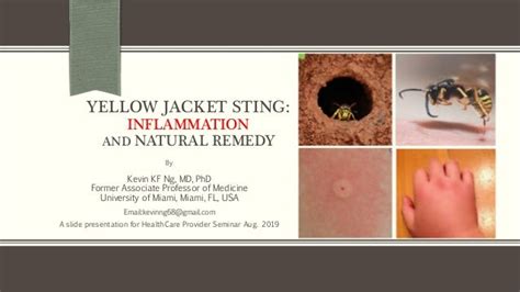 Yellow jacket sting: Inflammation and natural remedy