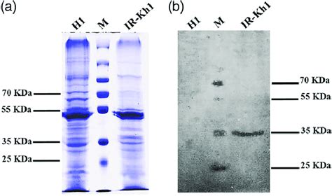 SDS-polyacrylamide gel (SDS-PAGE) (a) and western blotting (b) of total... | Download Scientific ...