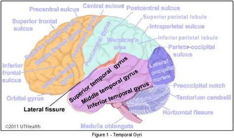 Neuroanatomy Online: Lab 1 - Overview of the Nervous System - Cerebral Lobes - Temporal Lobe ...