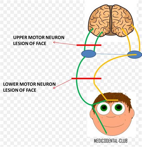 Lower Motor Neuron Lesion Facial Nerve Upper Motor Neuron Lesion, PNG, 1060x1102px, Watercolor ...