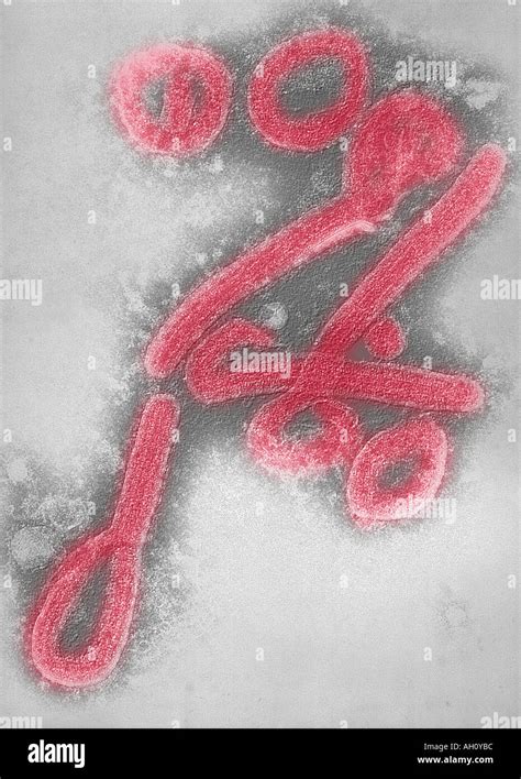 Marburg Virus High Resolution Stock Photography and Images - Alamy