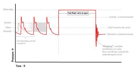 Information derived from the arterial pressure waveform | Deranged Physiology