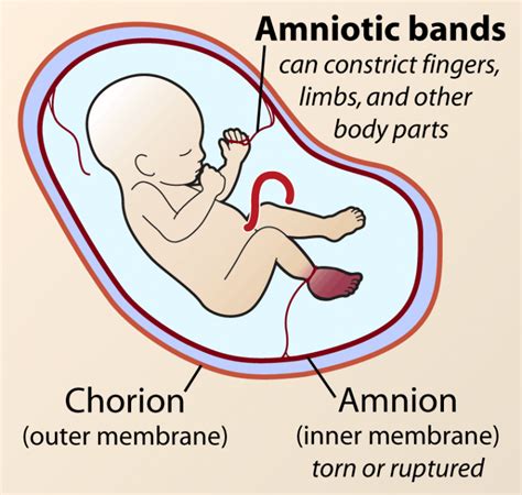 Fetal membrane layers, Chorion, Amnion, Yolk sac & umbilical cord | Science online