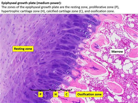 Bone – Normal Histology – NUS Pathweb :: NUS Pathweb