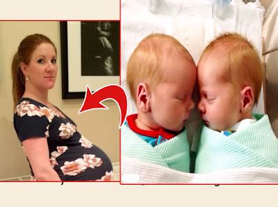 Mother With Giant Baby Bump Gives Birth To The Heaviest Twins In Scotland's History ...