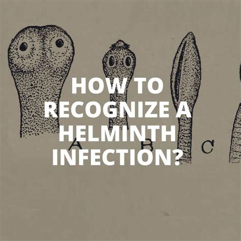 How to recognize a helminth infection? - SIXMD - Vietnamese Online Shop