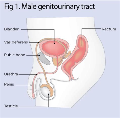 Male Urinary Catheter