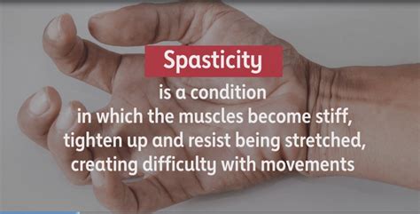 Spasticity | American Stroke Association