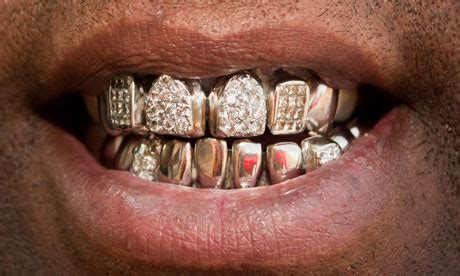 Big picture: Gold teeth, by Laurisa Galvan | Art and design | The Guardian