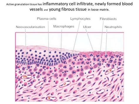 What Is Granulation Tissue - slideshare