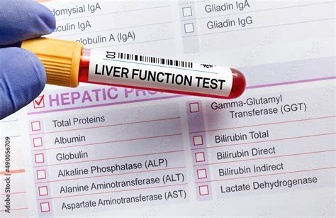 Blood tube test with requisition form for Liver Function Test LFT ...