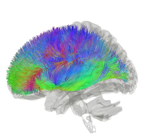 Last month, we learned that #LongCovid is associated with injury to two brain regions within the ...