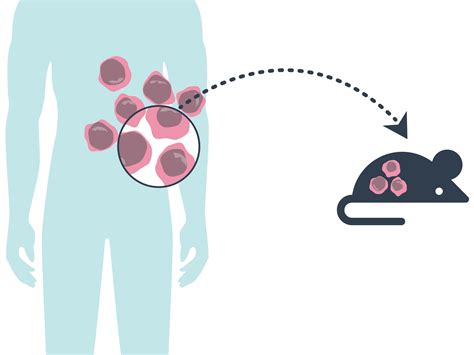 PDX Mouse Models Match Genetics of Human Tumors - NCI