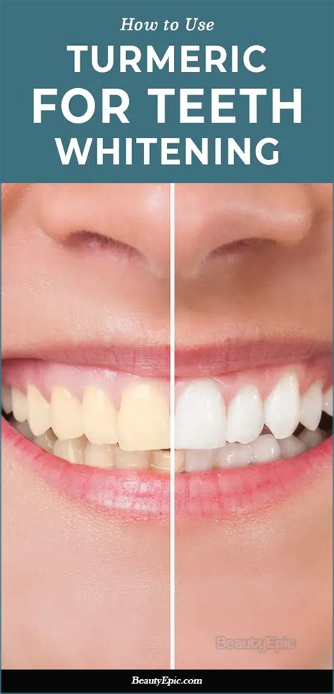 Does Turmeric Helps Teeth Whitening? In 2024