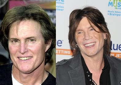 John Rzeznik Plastic Surgery Before And After Photos