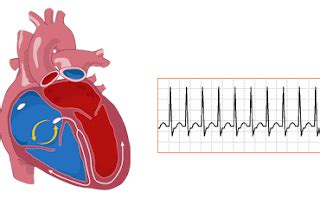 Pansystolic Murmur Symptoms, Causes, Sound, Treatment - Health Care ...