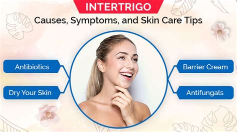 Intertrigo: Causes, Symptoms, and Skin Care Tips