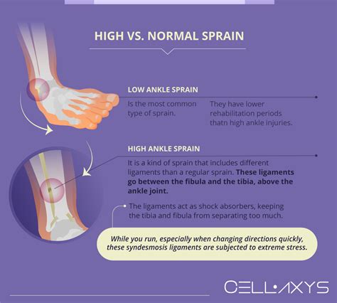 High Ankle Sprains And Regenerative Therapies - Cellaxys