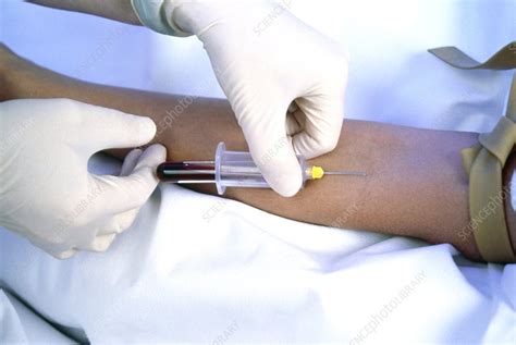 Blood sampling - Stock Image - M532/0559 - Science Photo Library