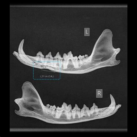 X-ray of compression fracture (marked by a square) of the left mandible... | Download Scientific ...