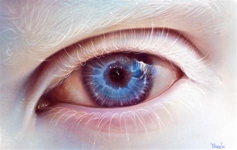 albino eye by ElenaSai on DeviantArt