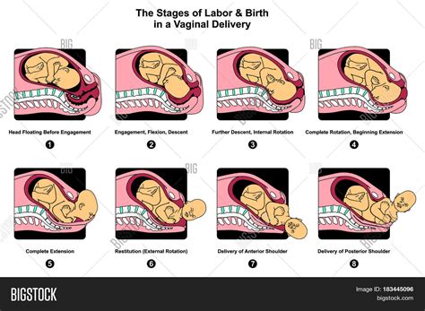 Stages Labor Birth Image & Photo (Free Trial) | Bigstock