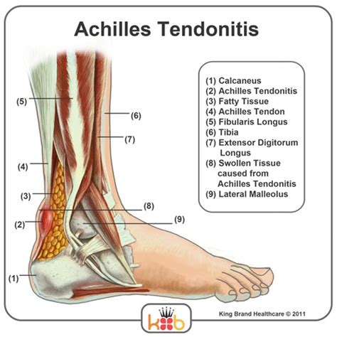 Tendon Diagram : wrist-tendon-diagram.jpg Photo by stragenism | Photobucket : The annulus of ...