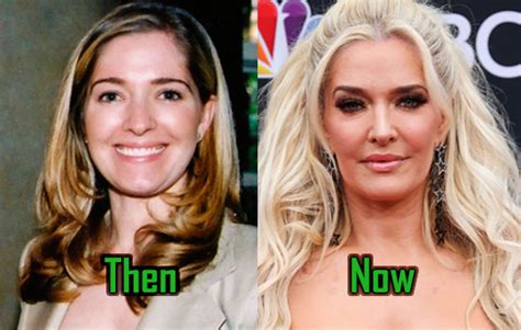 Erika Jayne Lengthens RHOBH Plastic Surgery List, Shocking Before-After ...