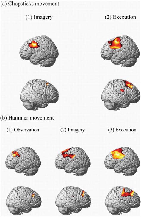 Motor Imagery and Action Observation as Effective Tools for Physical Therapy | IntechOpen