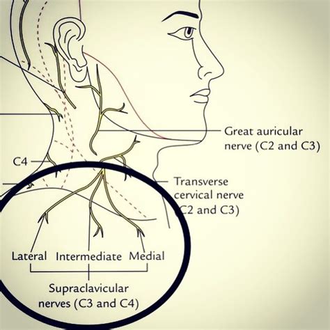 Anatomy of the day: Supraclavicular Cutaneous Nerves. People all too ...