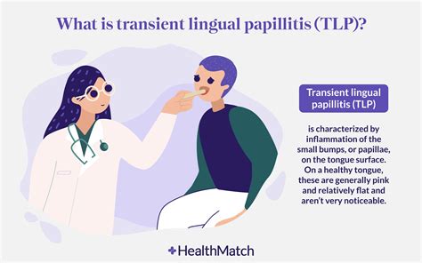 HealthMatch - How Do You Get Rid of Transient Lingual Papillitis? The ...