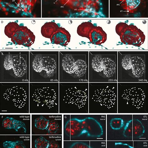 (PDF) In vivo imaging of cardiac development and function in zebrafish using light sheet microscopy