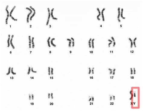 Chromosome Y in red, next to the much larger X chromosome. Credit: National Human Genome ...