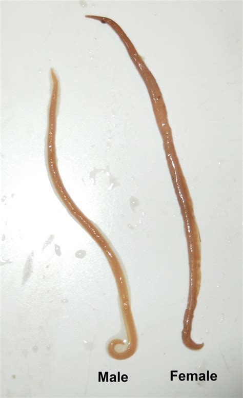 Ascaris lumbricoides (Large Roundworm) – Adult – Parasitology