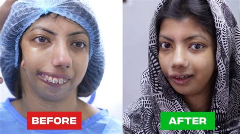 The Most Stunning Plastic Surgery Transformation - Oasis Medical Aesthetics