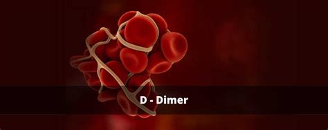 D-Dimer Assay “It is a powerful diagnostic tool in the detection of intravascular coagulation ...