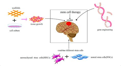 | Current trends in stem cell therapy for ischemic stroke. The... | Download Scientific Diagram