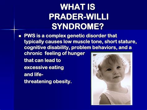 PPT - LIVING WITH PRADER-WILLI SYNDROME PowerPoint Presentation, free ...