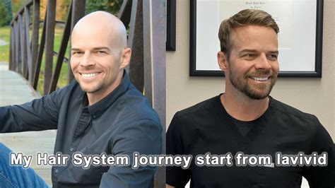 Hair System journey start from LaVivid | LaVivid Hair System - YouTube