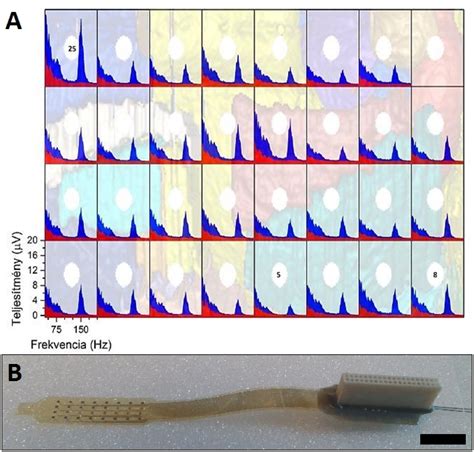 Polymer grid electrodes – NeuroMEMS