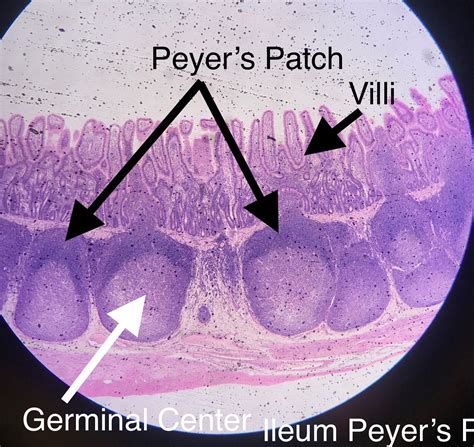 Peyer's Patch Histology.