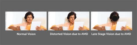 AMD - Amritsar Eye Clinic