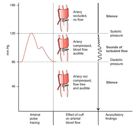 tisztít gát Az értelmező silent gap in blood pressure measurement Liszt Megbízható Gengszter