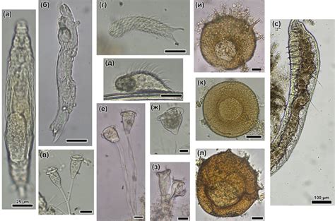 Micrographs of part of periphyton organisms found during the study: a ...