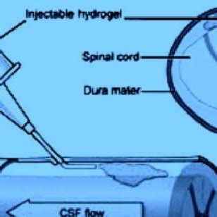 A minimally-invasive intrathecal drug delivery system for spinal cord... | Download Scientific ...