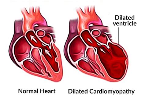 Dilated cardiomyopathy (DCM) in dogs and cats - Parys Vet