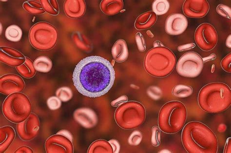 Penyakit Thalassemia: Gejala, Penyebab dan Cara Mengobati