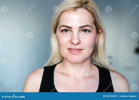 Woman Papules Face, Skin Texture Of Woman. Royalty-Free Stock Image | CartoonDealer.com #254406124