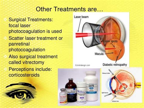 Diabetic retinopathy group 7 period 2 new 4